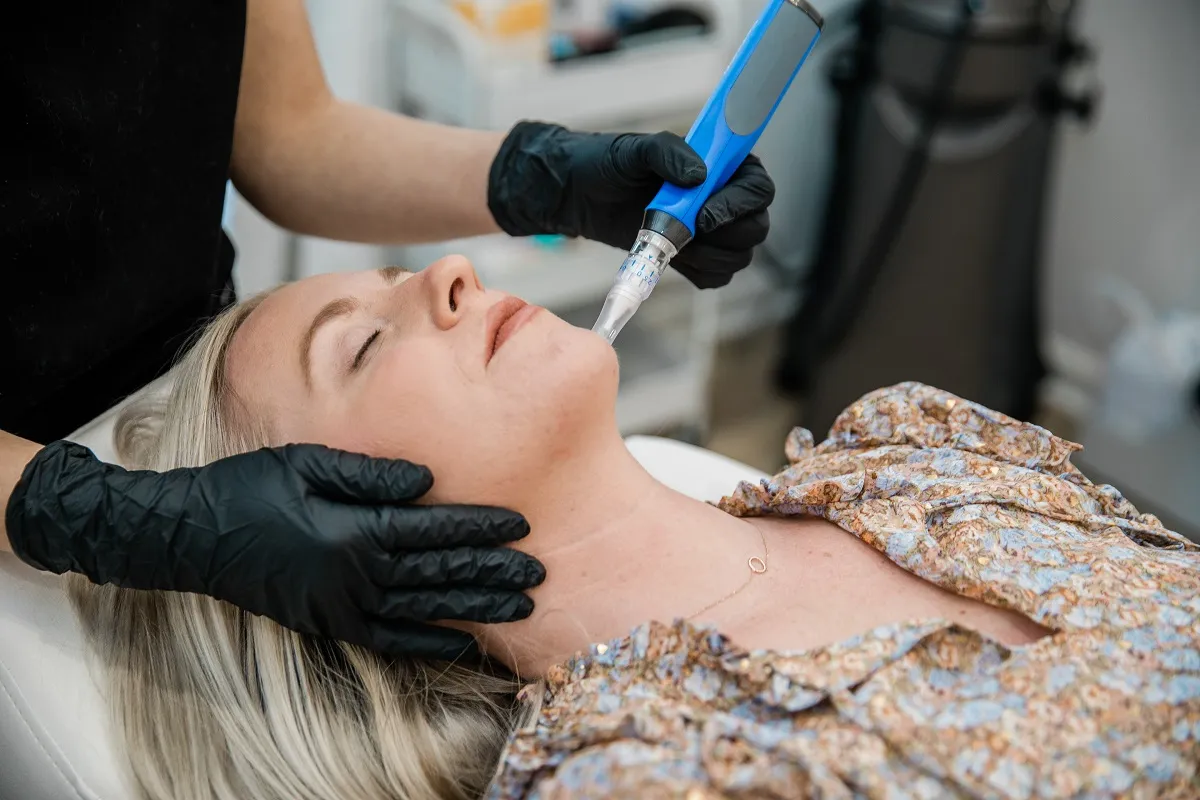 Microneedling in Manhasset, NY