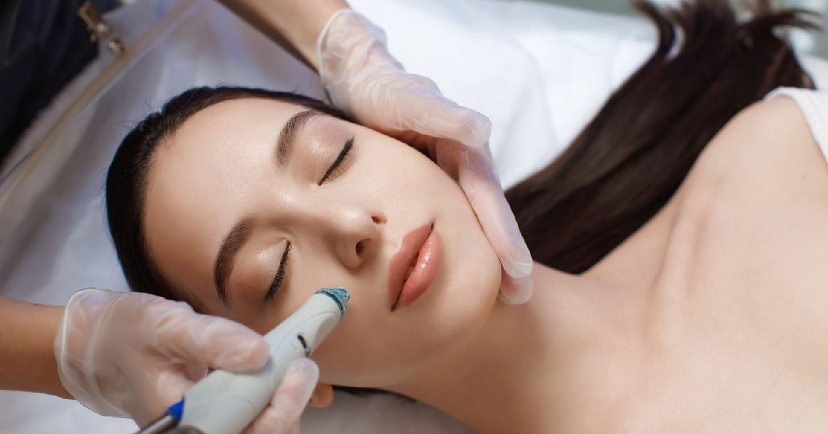 Woman receiving Microneedling Treatment in Great Neck, NY from a Professional